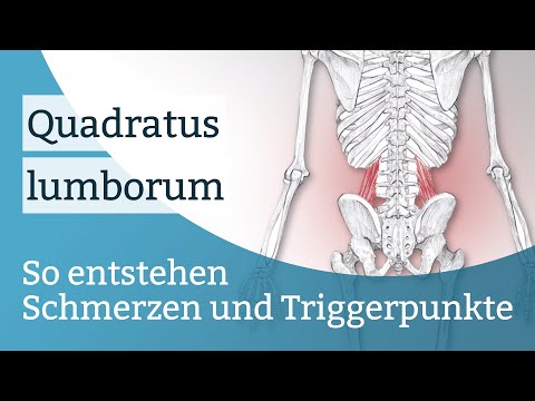 Quadratus lumborum pain, trigger points and their activation