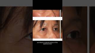 Nava Face & Eye
