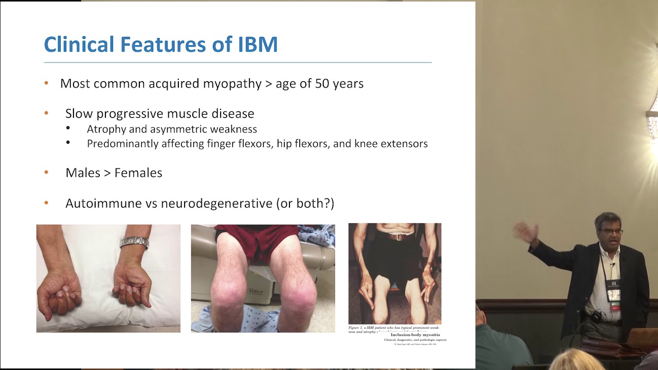Clinical features and progression of Inclusion Body Myositis, Tahseen Mozaffar, MD