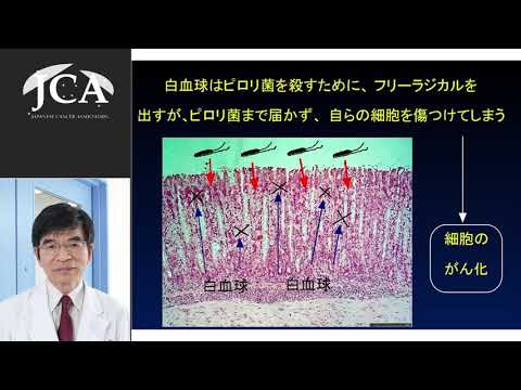 栄養学科 講演4「ピロリ菌感染と胃がん予防」谷中 昭典（筑波大学医学医療系消化器内科）