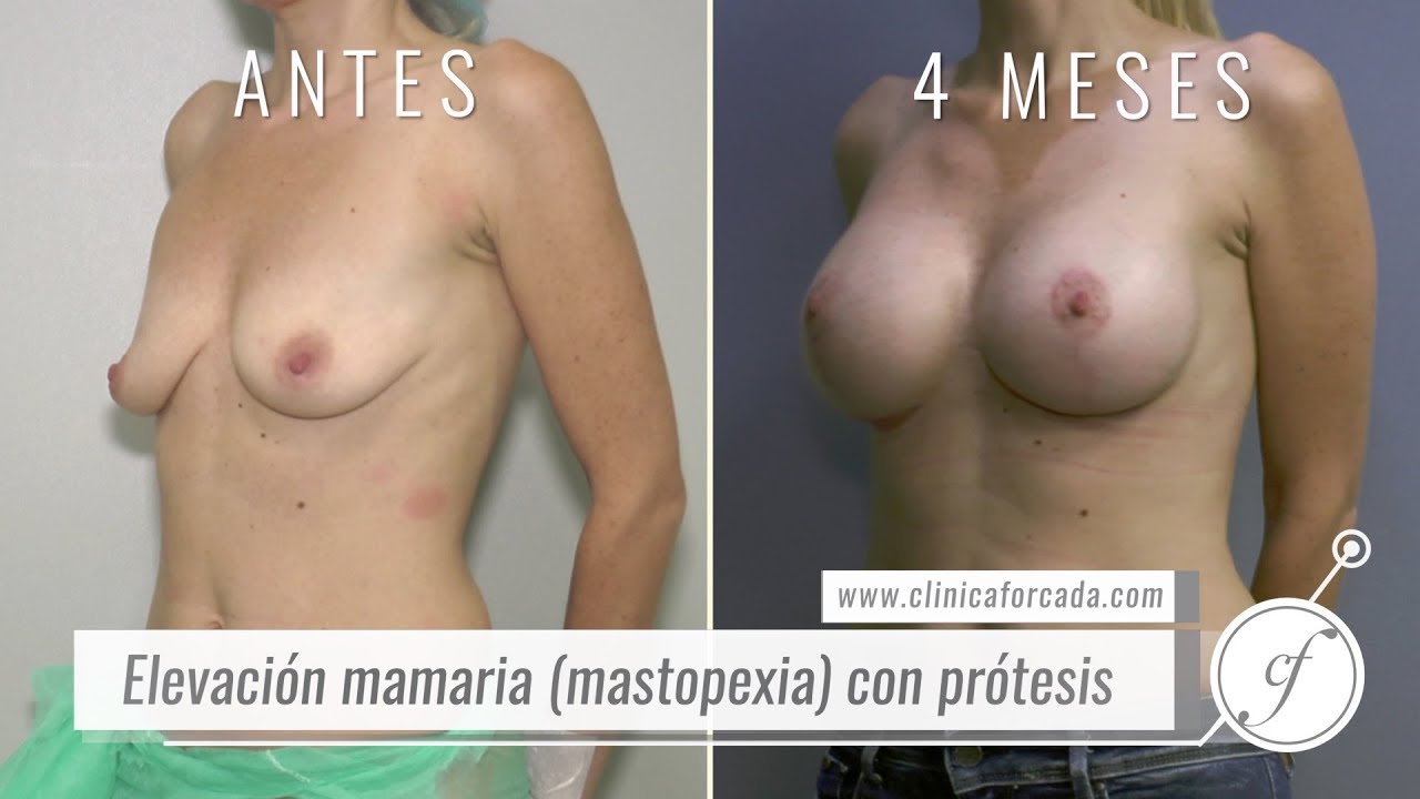 Eduardo Forcada Melero-39