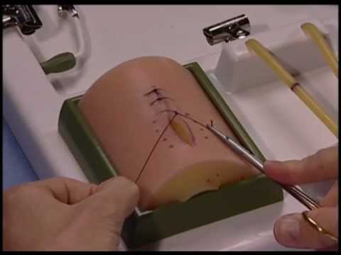 Common Errors in Performing an Instrument Tie: failure to cross hands