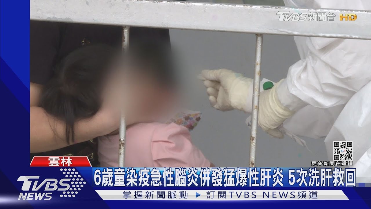 6歲童染疫急性腦炎併發猛爆性肝炎 5次洗肝救回