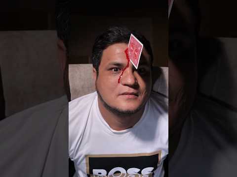 Gambit "BEST of the BEST"  🤫. #gambit #focus