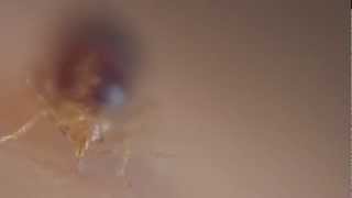 ANTICIMEX ® BEDBUGS - CHINCHES DE CAMA - Ingesta de sangre