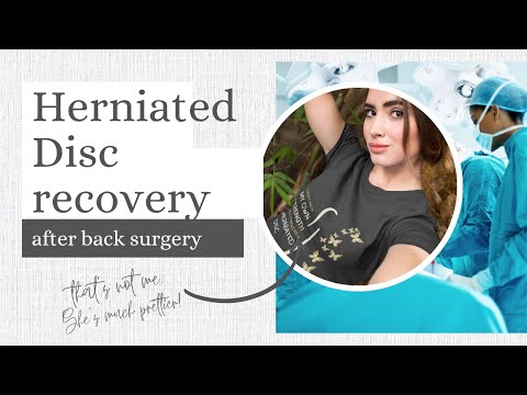 Herniated Disc surgery recovery story | Microdiscectomy recovery