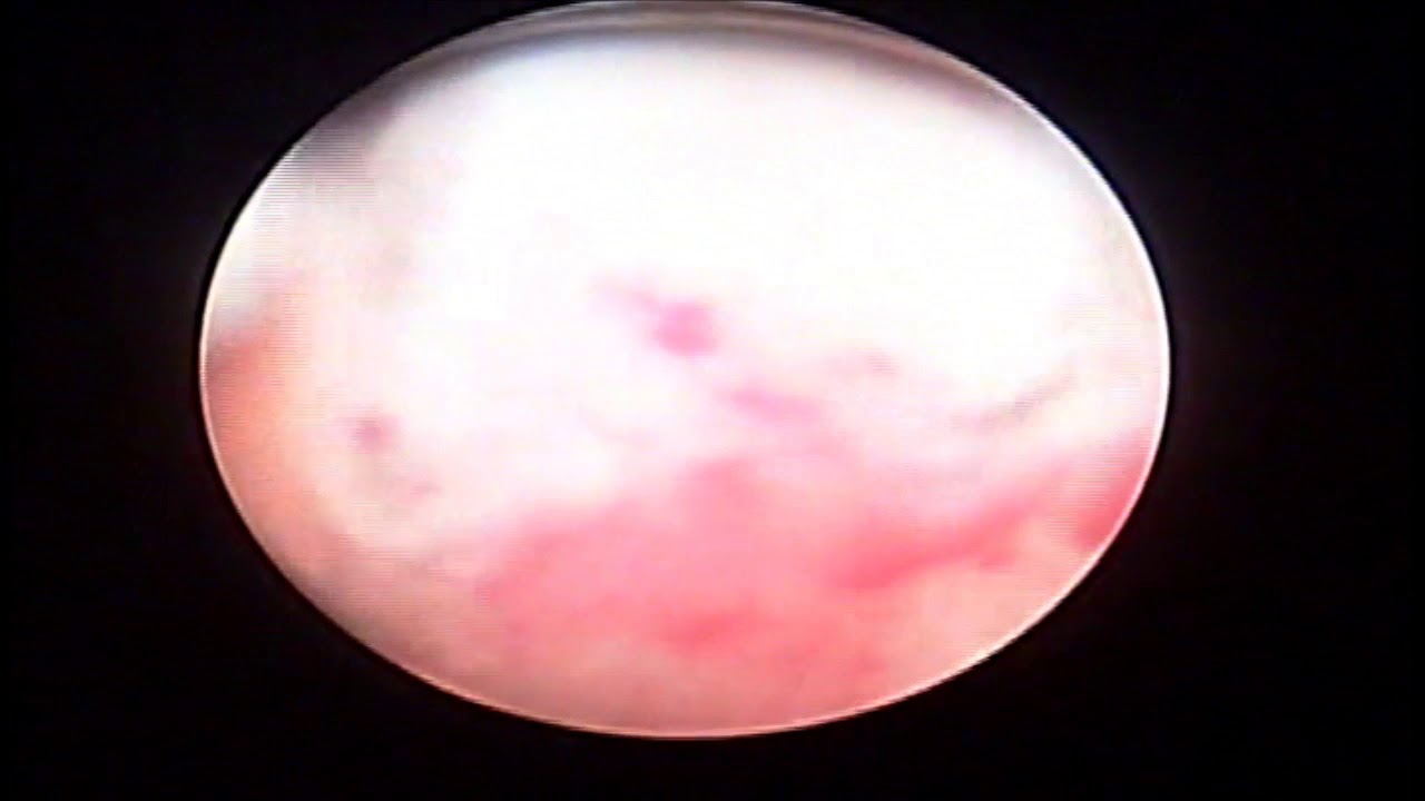 Tomás Alejandro Qué Patiño-37