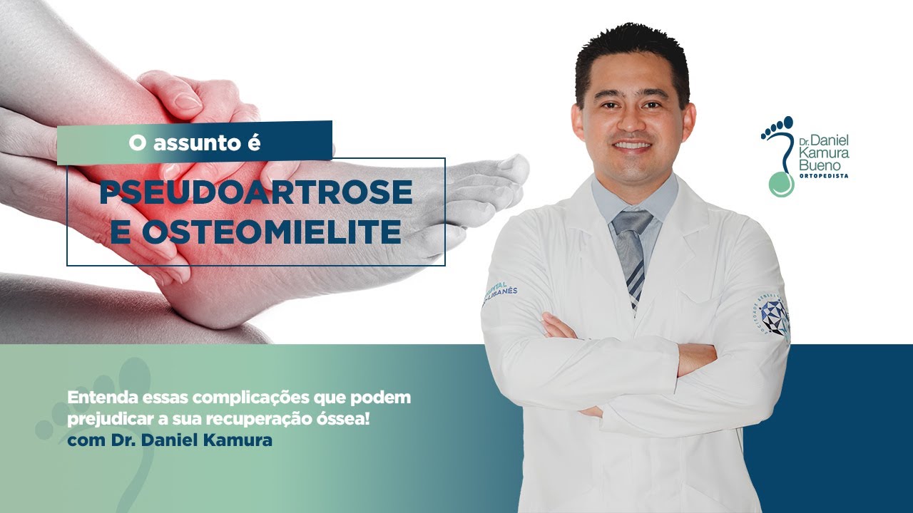 Pseudoartrose e Osteomielite: Duas Complicações Graves que Afetam Seus Ossos!