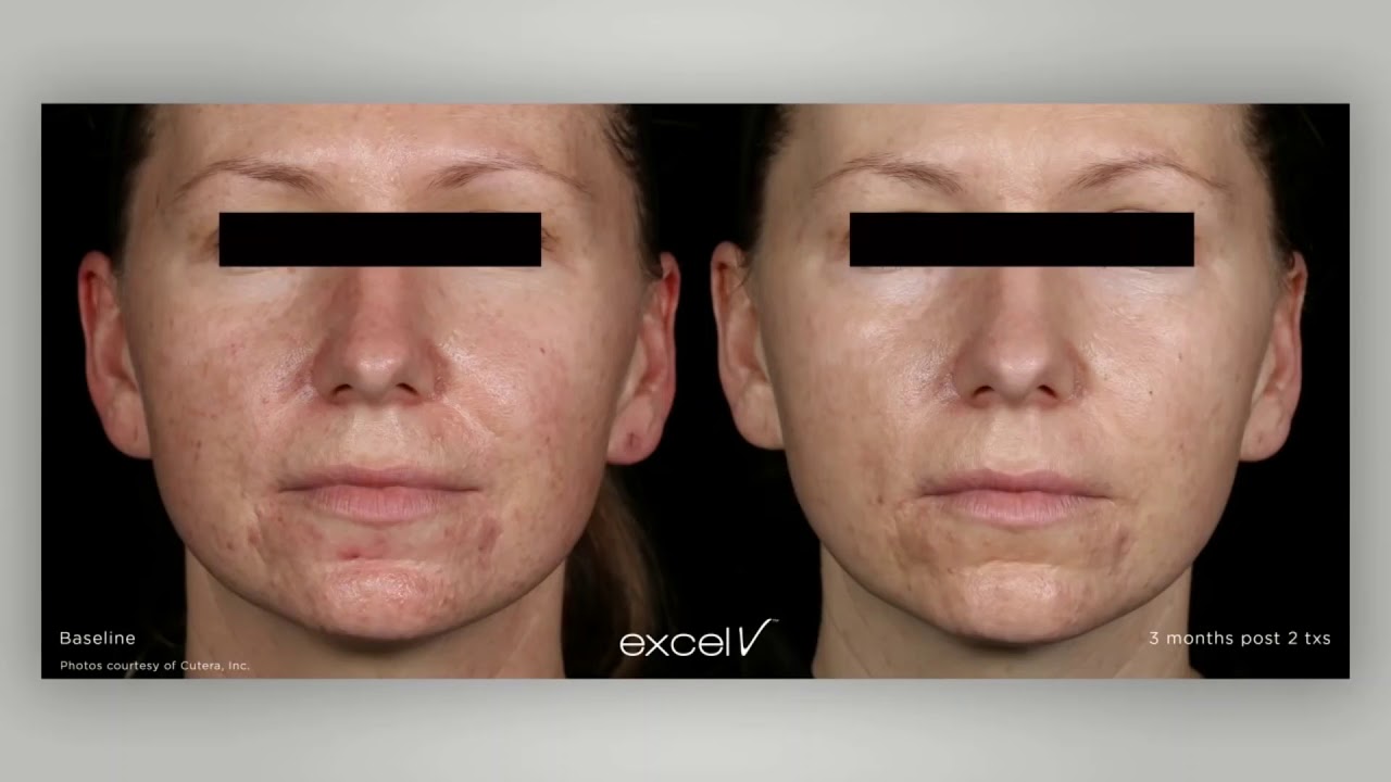 Grzegorz Kołodziejski-3