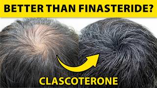 This NEW Hair Loss Treatment Regrows 539% More Hair? (Clascoterone)