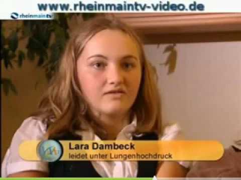 Eine Reihe von Übungen für Hypertonie auf Bubnovsky ACE-Hemmern bei der Behandlung von Bluthochdruck