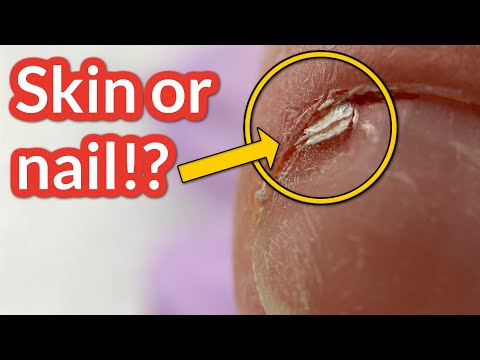 She Sliced Her Nail with This Manicure Tool 😱