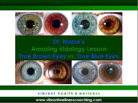 Dr. Morse's Amazing Iridology Lesson:  True Brown Eyes vs. True Blue Eyes