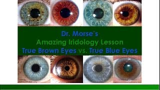 Dr. Morse&#39;s Amazing Iridology Lesson:  True Brown Eyes vs. True Blue Eyes