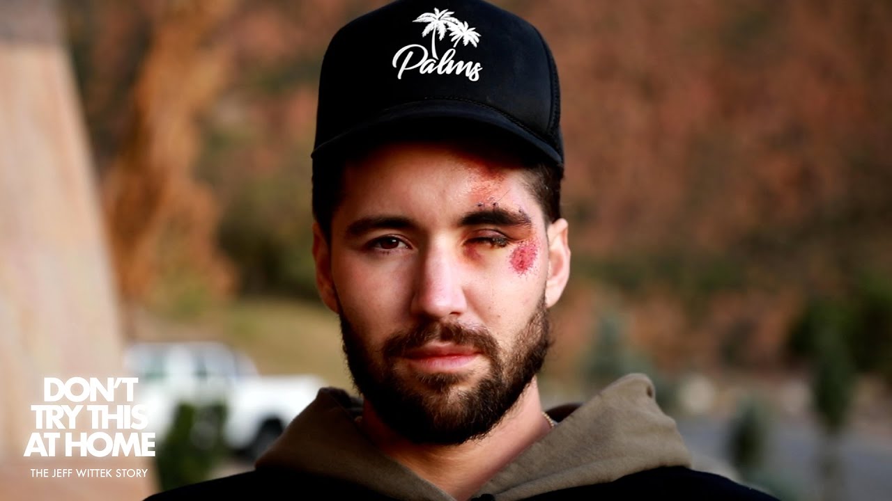 Un youtuber se rompe la cara