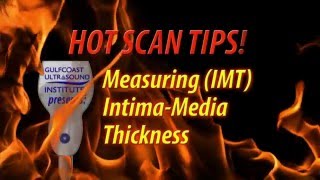 Hot Tip-Measuring Intima Media Thickness