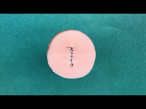 Tutorial: running locking suture