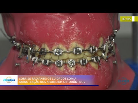Cuidados necessários com manutenção de aparelhos ortodí´nticos 03 05 2021