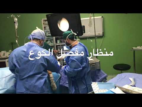 أفضل واشطر دكتور عظام ومفاصل