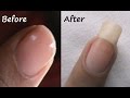 How to Grow Nails Faster Naturally ...