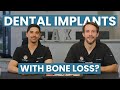 Dental Implants For People Who Have Been Told They Have No Bone!