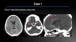 2025 MR and CT Advanced Imaging and Artificial Intelligence