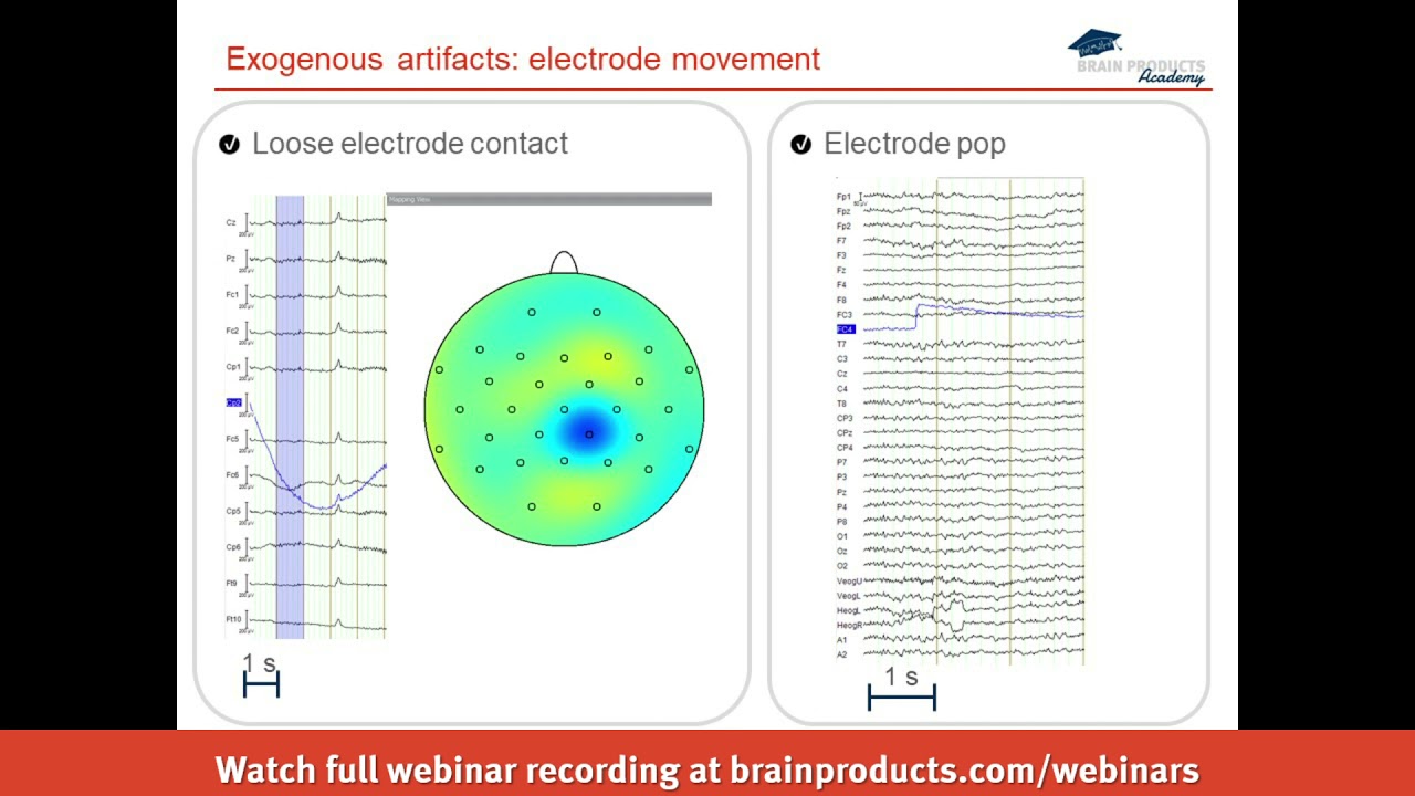 EEG artifact types and handling strategies in BrainVision Analyzer 2