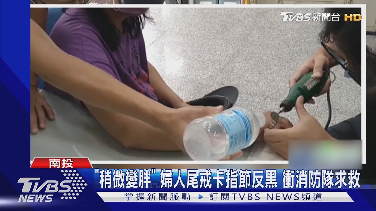「稍微變胖」婦人尾戒卡指節反黑 衝消防隊求救