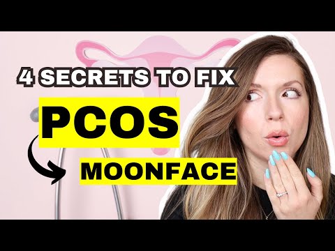 How to Reduce Facial Puffiness + Bloating | PCOS MOON FACE