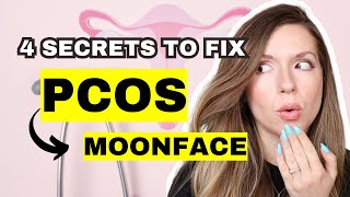 How to Reduce Facial Puffiness + Bloating | PCOS MOON FACE