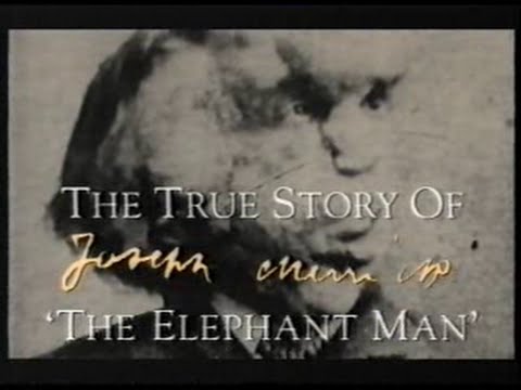 The Elephant man - QED - Documentary - The True Story Of Joseph Merrick