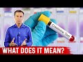 Causes Of High Creatinine Levels In Blood Dr Berg On Elevated Creatinine Levels