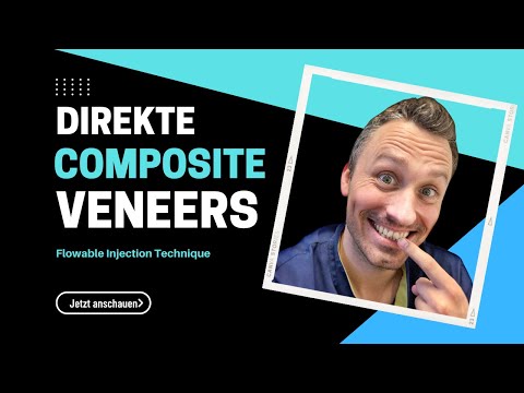 Schöne Zähne dank der Flowable Injection Technique 😍🙌 | Zahnarzt Dr. Maximilian Fuhrmann