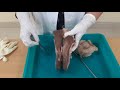 Makroskopische Anatomie Der Weiblichen äußeren Geschlechtsorgane