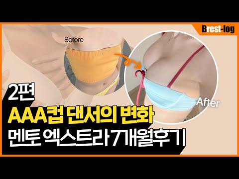 가슴성형 브이로그 주인공 인터뷰 I 제니처럼 자연스러운 가슴 2개월 후기 I 윈느성형외과 | 윈느성형외과 라벨윈느 유튜브 영상