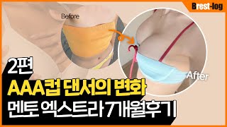 윈느성형외과 유튜브 영상 썸네일