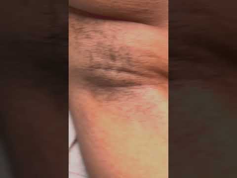 Shaved Naked Pics