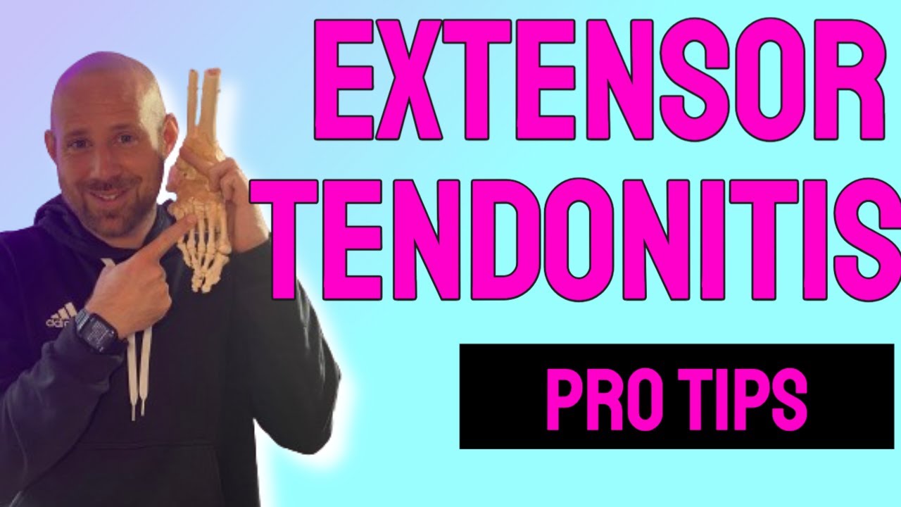 Beat Extensor Tendonitis: Causes, Treatment, and Pain Relief!