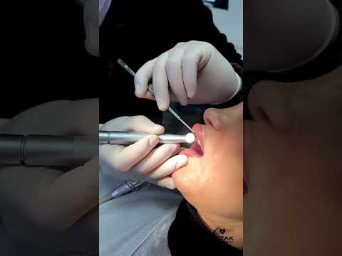 Dent Island Kusadasi...