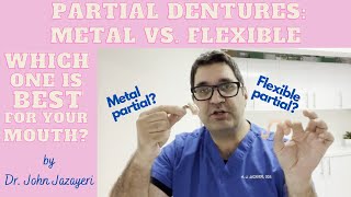 Metal Partial vs. Flexible Partial: Which Do You Choose
