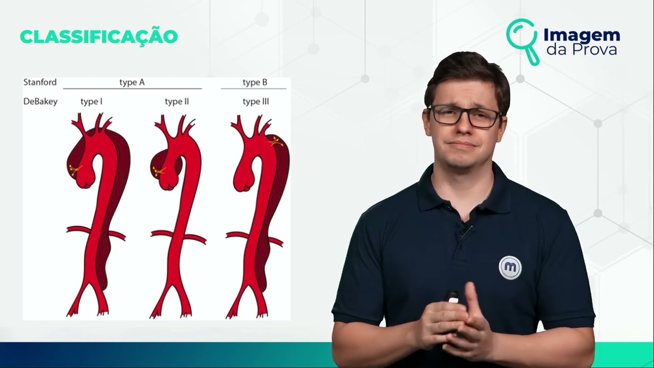 Imagem da Prova: DISSECÇÃO Aguda da AORTA | Radiologia | Medway