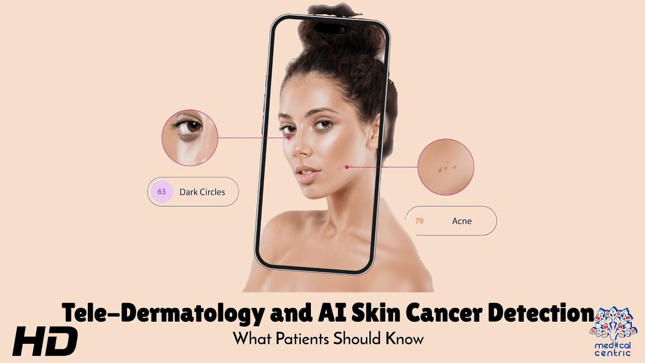 Tele-Dermatology and AI Skin Cancer Detection : What You Need to Know