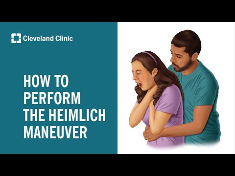 How To Perform the Heimlich Maneuver