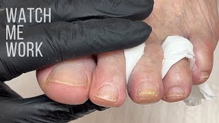 Watch me work and explain dry pedicure.