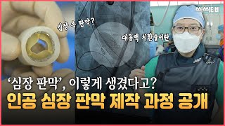  ΰ Ǹ   ! 뵿Ǹġȯ(TAVI)?