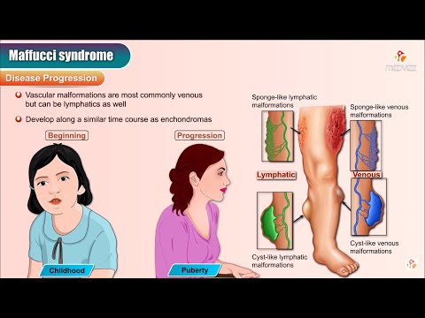 Maffucci's syndrome - Animation