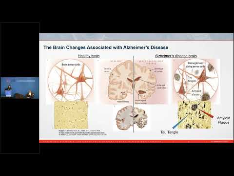 Amyloid-beta PET utility in Alzheimer’s desease / Symposium CANM Annual Conference 2022