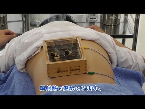腰痛の鍼(はり)治療