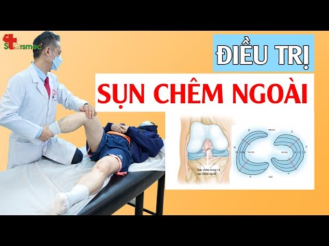 Rách sụn chêm ngoài - Điều trị thế nào?