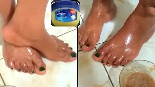 Remove wrinkles from foot 5 minute foot treatment remove wrinkle & rough feet